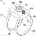 Fig. 01 - ULTRASONIC DEVICE