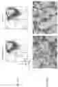 Fig. 18 - BETA-THALASSEMIA POTENCY ASSAY