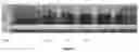 Fig. 05 - APPARATUS, METHOD AND KIT FOR DETECTION OF VON WILLEBRAND FACTOR AND FACTOR VIII