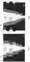Fig. 03 - SLICE ALIGNMENT FOR SHORT AXIS CARDIAC MR CINE SLICE STACKS