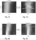 Fig. 05 - METHOD AND SYSTEM FOR COMPSENSATING DEPTH-DEPENDENT ATTENUATION IN ULTRASONIC SIGNAL DATA
