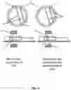 Fig. 05 - Close-range positron emission tomography modules and system