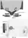 Fig. 13 - Dog bone shaped cylindrical tunable fluidic lens with minimized defocus