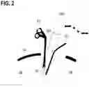Fig. 03 - Context-dependent control of a surgical microscope