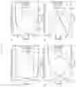 Fig. 15 - Augmented reality display having improved FOV, and waveguide device and diffractive optical structures thereof