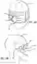Fig. 23 - Wearable heads up displays