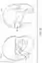 Fig. 45 - Wearable heads up displays