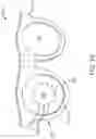 Fig. 03 - Methods for the treatment of refractive error using active stimulation
