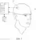 Fig. 02 - Intraocular brain interface