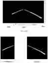 Fig. 05 - Method and system for detecting lane pattern