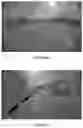 Fig. 07 - Method and system for detecting lane pattern