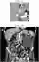 Fig. 09 - METHOD AND SYSTEM OF STATISTICAL IMAGE RESTORATION FOR LOW-DOSE CT IMAGE USING DEEP LEARNING