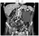 Fig. 11 - METHOD AND SYSTEM OF STATISTICAL IMAGE RESTORATION FOR LOW-DOSE CT IMAGE USING DEEP LEARNING
