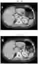 Fig. 13 - METHOD AND SYSTEM OF STATISTICAL IMAGE RESTORATION FOR LOW-DOSE CT IMAGE USING DEEP LEARNING