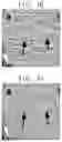 Fig. 14 - METHOD AND SYSTEM OF STATISTICAL IMAGE RESTORATION FOR LOW-DOSE CT IMAGE USING DEEP LEARNING