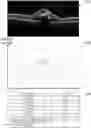 Fig. 01 - Ophthalmic image processing device and ophthalmic image processing method