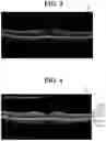 Fig. 04 - Ophthalmic image processing device and ophthalmic image processing method