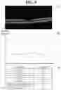 Fig. 08 - Ophthalmic image processing device and ophthalmic image processing method