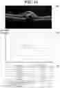 Fig. 09 - Ophthalmic image processing device and ophthalmic image processing method