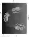 Fig. 06 - Multifaceted registration of intraoral scans