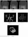 Fig. 09 - Method of establishing an enhanced three-dimensional model of intracranial angiography