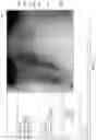 Fig. 13 - System and method for visualizing placement of a medical tube or line