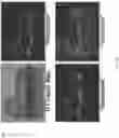 Fig. 16 - Computer Vision Systems and Methods for High-Fidelity Representation of Complex 3D Surfaces Using Deep Unsigned Distance Embeddings
