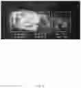 Fig. 15 - Device and method for recognizing obstacle of vehicle