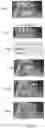 Fig. 08 - Systems and methods for performing fingerprint based user authentication using imagery captured using mobile devices