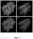Fig. 03 - TUMOR ANTIGENICITY PROCESSING AND PRESENTATION