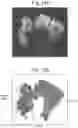 Fig. 23 - Tissue analysis by mass spectrometry or ion mobility spectrometry