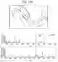 Fig. 48 - Tissue analysis by mass spectrometry or ion mobility spectrometry