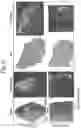 Fig. 60 - Tissue analysis by mass spectrometry or ion mobility spectrometry