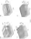 Fig. 13 - Selective patterning of vias with hardmasks