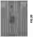Fig. 19 - Laser-formed interconnects for redundant devices