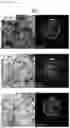 Fig. 35 - Spin-orbit torque (SOT)-based magnetic tunnel junction and method of fabricating the same
