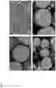 Fig. 04 - COMPOSITE METAL OXIDE FOR LITHIUM SECONDARY BATTERY COMPRISING DOPING ELEMENT, POSITIVE ELECTRODE ACTIVE MATERIAL FOR LITHIUM SECONDARY BATTERY PREPARED FROM SAME, AND LITHIUM SECONDARY BATTERY COMPRISING SAME
