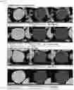 Fig. 14 - COMPOSITE METAL OXIDE FOR LITHIUM SECONDARY BATTERY COMPRISING DOPING ELEMENT, POSITIVE ELECTRODE ACTIVE MATERIAL FOR LITHIUM SECONDARY BATTERY PREPARED FROM SAME, AND LITHIUM SECONDARY BATTERY COMPRISING SAME