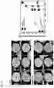 Fig. 16 - COMPOSITE METAL OXIDE FOR LITHIUM SECONDARY BATTERY COMPRISING DOPING ELEMENT, POSITIVE ELECTRODE ACTIVE MATERIAL FOR LITHIUM SECONDARY BATTERY PREPARED FROM SAME, AND LITHIUM SECONDARY BATTERY COMPRISING SAME