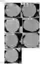 Fig. 33 - COMPOSITE METAL OXIDE FOR LITHIUM SECONDARY BATTERY COMPRISING DOPING ELEMENT, POSITIVE ELECTRODE ACTIVE MATERIAL FOR LITHIUM SECONDARY BATTERY PREPARED FROM SAME, AND LITHIUM SECONDARY BATTERY COMPRISING SAME