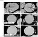 Fig. 35 - COMPOSITE METAL OXIDE FOR LITHIUM SECONDARY BATTERY COMPRISING DOPING ELEMENT, POSITIVE ELECTRODE ACTIVE MATERIAL FOR LITHIUM SECONDARY BATTERY PREPARED FROM SAME, AND LITHIUM SECONDARY BATTERY COMPRISING SAME