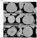 Fig. 40 - COMPOSITE METAL OXIDE FOR LITHIUM SECONDARY BATTERY COMPRISING DOPING ELEMENT, POSITIVE ELECTRODE ACTIVE MATERIAL FOR LITHIUM SECONDARY BATTERY PREPARED FROM SAME, AND LITHIUM SECONDARY BATTERY COMPRISING SAME