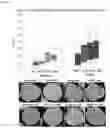 Fig. 42 - COMPOSITE METAL OXIDE FOR LITHIUM SECONDARY BATTERY COMPRISING DOPING ELEMENT, POSITIVE ELECTRODE ACTIVE MATERIAL FOR LITHIUM SECONDARY BATTERY PREPARED FROM SAME, AND LITHIUM SECONDARY BATTERY COMPRISING SAME