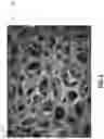 Fig. 03 - SOLID-STATE BIPOLAR BATTERY HAVING THICK ELECTRODES