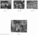 Fig. 04 - Thermal responsive electrode structure for lithium-ion batteries