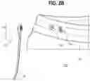 Fig. 05 - Electrically Grounded Clothing and Blanket