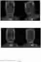 Fig. 17 - GENERATING AN AVATAR OF A PARTICIPANT OF A THREE DIMENSIONAL (3D) VIDEO CONFERENCE