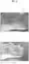 Fig. 10 - Dust measurement device