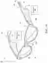 Fig. 02 - Active noise reduction in open ear directional acoustic devices