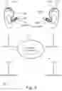Fig. 03 - Binaural hearing system comprising bilateral compression